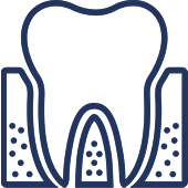 Tooth cross-section diagram showing root, pulp, and surrounding bone structure in dental illustration.