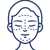 Simple line drawing of a smiling face with closed eyes and dotted acne marks on cheeks and forehead.