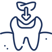 Tooth with downward arrow and dental crown icon representing restorative dentistry treatment.
