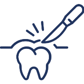 Dental tool treating tooth with light rays indicating professional dental care treatment.