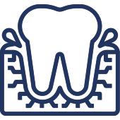 Tooth illustration with gum roots shown in cross-section, dental anatomy diagram.