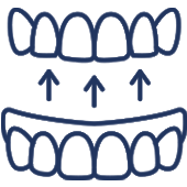 Dental bridge diagram showing upper and lower teeth with arrows indicating tooth movement or alignment adjustment.