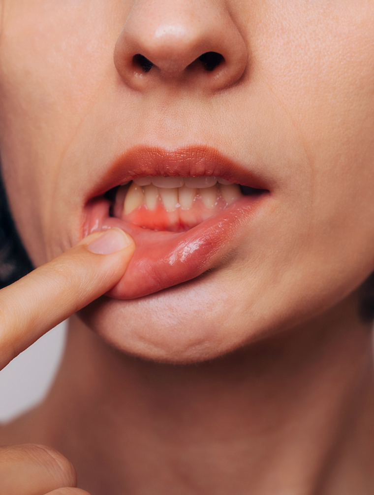 Person pointing to lips showing dental health and oral care examination.