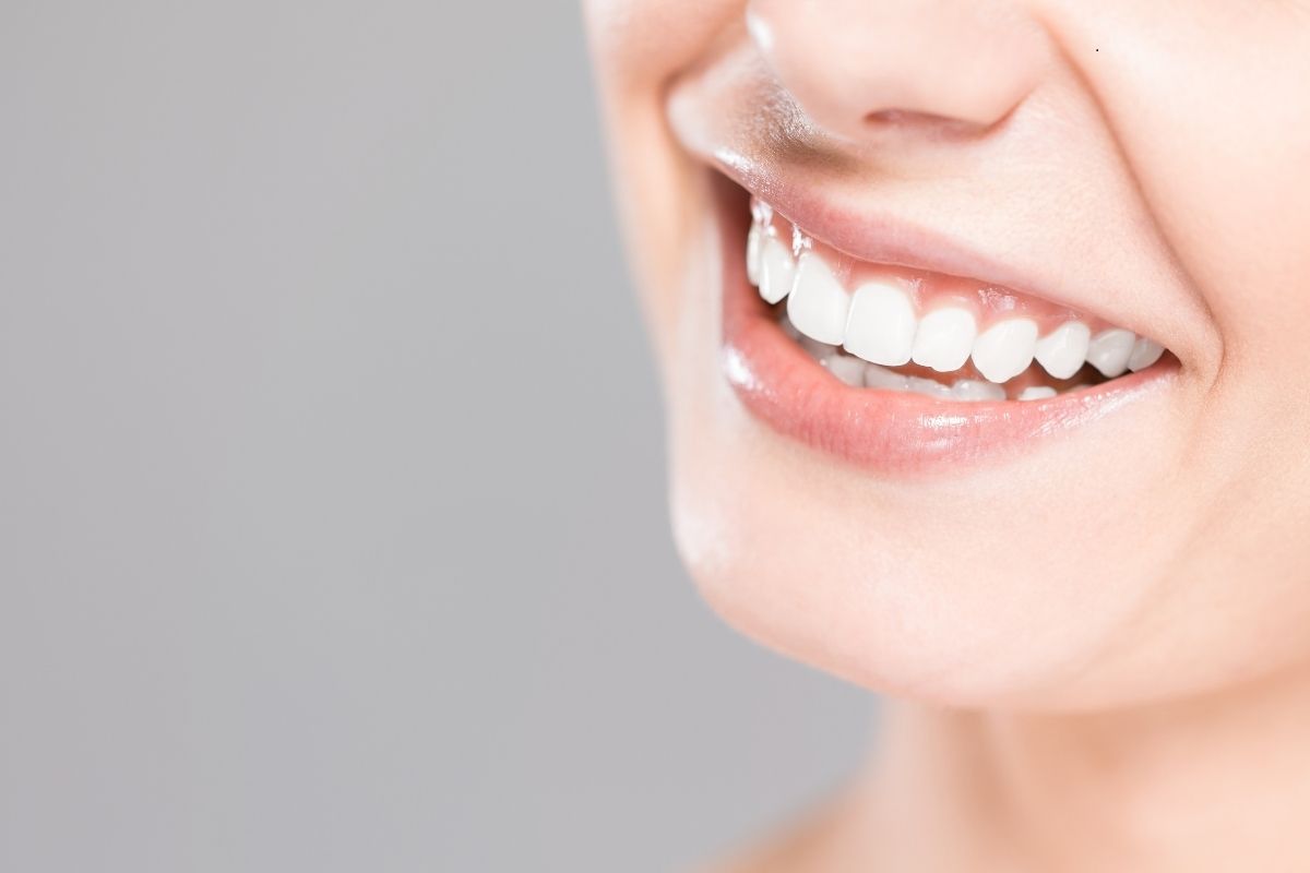 Teeth Whitening